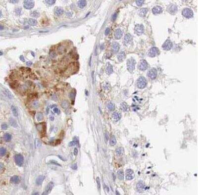 Immunohistochemistry-Paraffin: NSDHL Antibody [NBP1-83307] - Staining of human testis using Anti-NSDHL antibody.