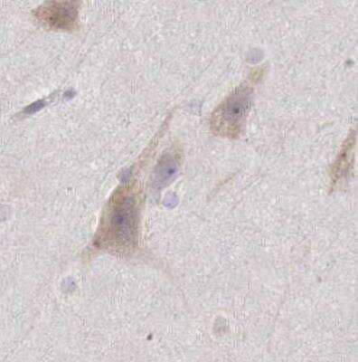 Immunohistochemistry-Paraffin: NSDHL Antibody [NBP1-83307] - Staining of human cerebral cortex using Anti-NSDHL antibody.