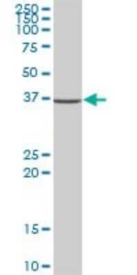 Western Blot: NSDHL Antibody [H00050814-B01P] - Analysis of NSDHL expression in human liver.