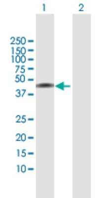 Western Blot: NSDHL Antibody [H00050814-B01P] - Analysis of NSDHL expression in transfected 293T cell line by NSDHL polyclonal antibody.  Lane 1: NSDHL transfected lysate(41.03 KDa). Lane 2: Non-transfected lysate.