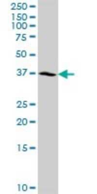 Western Blot: NSDHL Antibody [H00050814-D01P] - Analysis of NSDHL expression in A-431.