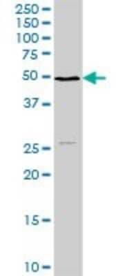 Western Blot: NSDHL Antibody [H00050814-D01P] - Analysis of NSDHL expression in mouse lung.