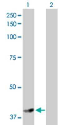 Western Blot: NSDHL Antibody [H00050814-D01P] - Analysis of NSDHL expression in transfected 293T cell line by NSDHL polyclonal antibody.Lane 1: NSDHL transfected lysate(41.90 KDa).Lane 2: Non-transfected lysate.