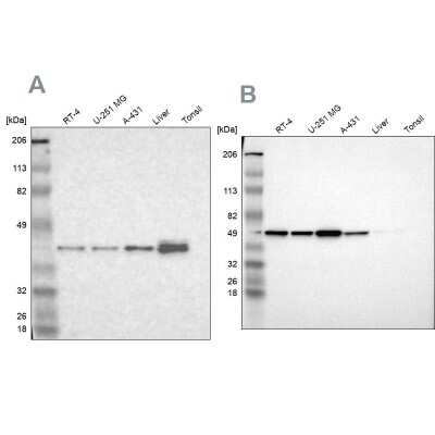 <b>Independent Antibodies Validation. </b>Western Blot: NSDHL Antibody [NBP1-83306] - Analysis using Anti-NSDHL antibody NBP1-83306 (A) shows similar pattern to independent antibody NBP1-83307 (B).