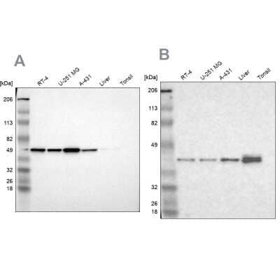 <b>Independent Antibodies Validation. </b>Western Blot: NSDHL Antibody [NBP1-83307] - Analysis using Anti-NSDHL antibody NBP1-83307 (A) shows similar pattern to independent antibody NBP1-83306 (B).