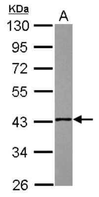 Western Blot: NSDHL Antibody [NBP2-19590] - Sample (30 ug of whole cell lysate) A: A431 10% SDS PAGE gel, diluted at 1:1000.