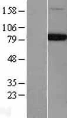 Western Blot: NSF Overexpression Lysate (Adult Normal) [NBL1-13808] Left-Empty vector transfected control cell lysate (HEK293 cell lysate); Right -Over-expression Lysate for NSF.