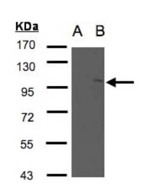 Western Blot NSMAF Antibody