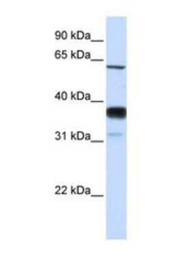 Western Blot: NSMASE2 Antibody [NBP1-69344] - This Anti-SMPD3 antibody was used in Western Blot of Fetal Lung tissue lysate at a concentration of 1ug/ml.