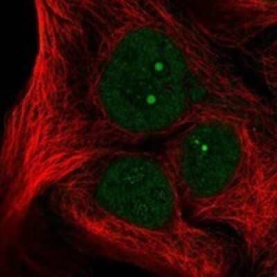 Immunocytochemistry/Immunofluorescence: NSP 5 alpha 3 alpha Antibody [NBP3-17187] - Staining of human cell line CACO-2 shows localization to nucleoplasm & nucleoli fibrillar center.