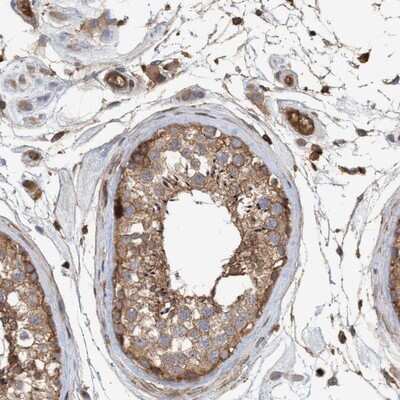 Immunohistochemistry-Paraffin: NSP 5 alpha 3 alpha Antibody [NBP1-85352] - Staining of human testis shows moderate cytoplasmic positivity in cells in seminiferus ducts.