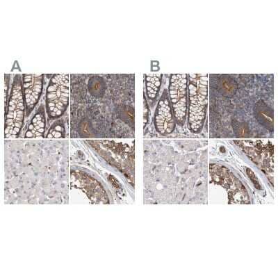 <b>Independent Antibodies Validation. </b>Immunohistochemistry-Paraffin: NSP 5 alpha 3 alpha Antibody [NBP1-85352] - Staining of human colon, endometrium, liver and testis using Anti-SPECC1 antibody NBP1-85352 (A) shows similar protein distribution across tissues to independent antibody NBP1-85353 (B).