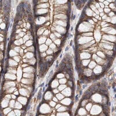 Immunohistochemistry-Paraffin: NSP 5 alpha 3 alpha Antibody [NBP1-85352] - Staining of human colon.