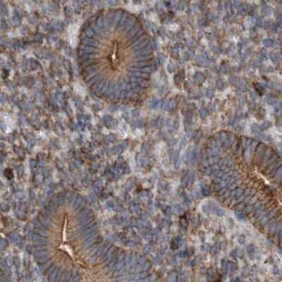 Immunohistochemistry-Paraffin: NSP 5 alpha 3 alpha Antibody [NBP1-85352] - Staining of human endometrium.