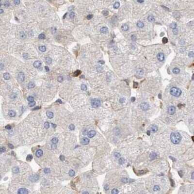 <b>Independent Antibodies Validation. </b>Immunohistochemistry-Paraffin: NSP 5 alpha 3 alpha Antibody [NBP1-85352] - Staining of human liver.