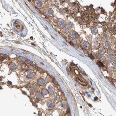 Immunohistochemistry-Paraffin: NSP 5 alpha 3 alpha Antibody [NBP1-85352] - Staining of human testis.