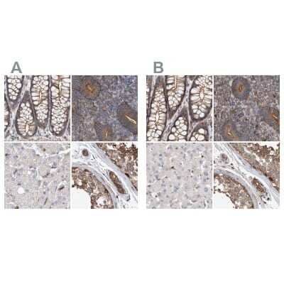 <b>Independent Antibodies Validation. </b>Immunohistochemistry-Paraffin: NSP 5 alpha 3 alpha Antibody [NBP1-85353] - Staining of human colon, endometrium, liver and testis using Anti-SPECC1 antibody NBP1-85353 (A) shows similar protein distribution across tissues to independent antibody NBP1-85352 (B).