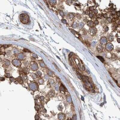 Immunohistochemistry-Paraffin: NSP 5 alpha 3 alpha Antibody [NBP1-85353] - Staining of human testis.