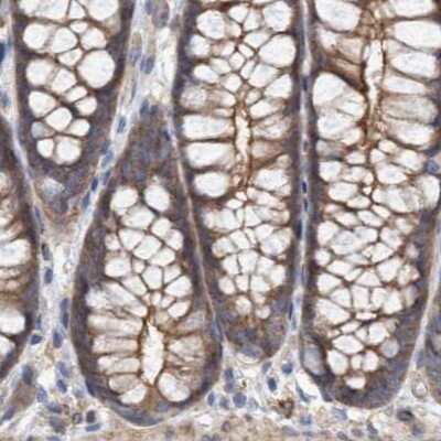 Immunohistochemistry-Paraffin: NSP 5 alpha 3 alpha Antibody [NBP1-85353] - Staining of human colon.