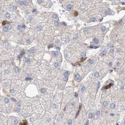 Immunohistochemistry-Paraffin: NSP 5 alpha 3 alpha Antibody [NBP1-85353] - Staining of human liver.