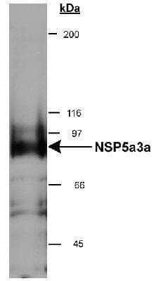 Western Blot: NSP 5 alpha 3 alpha Antibody [NB100-517] - Detection of NSP 5 alpha 3 alpha in HeLa whole cell lysate (RIPA) using NB100-517. 0.5ug/ml dilution, 15 second ECL detection.