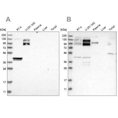 Western Blot: NSP 5 alpha 3 alpha Antibody [NBP1-85352] - Analysis using Anti-SPECC1 antibody NBP1-85352 (A) shows similar pattern to independent antibody NBP1-85353 (B).