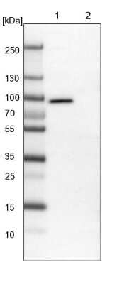 Western Blot: NSP 5 alpha 3 alpha Antibody [NBP1-85353] - Lane 1: NIH-3T3 cell lysate (Mouse embryonic fibroblast cells). Lane 2: NBT-II cell lysate (Rat Wistar bladder tumor cells).