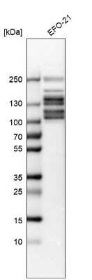 Western Blot: NSP 5 alpha 3 alpha Antibody [NBP1-85353] - Analysis in human cell line EFO-21.