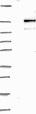 Western Blot: NSP 5 alpha 3 alpha Antibody [NBP3-17187] - Lane 1: Marker [kDa] 250, 130, 95, 72, 55, 36, 28, 17, 10;   Lane 2: RT4;   Lane 3: U-251 MG