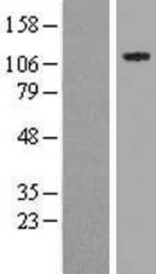 Western Blot: NSP 5 alpha 3 alpha Overexpression Lysate (Adult Normal) [NBP2-11599] Left-Empty vector transfected control cell lysate (HEK293 cell lysate); Right -Over-expression Lysate for NSP 5 alpha 3 alpha.