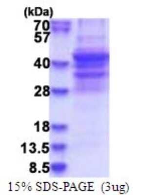 SDS-Page: NSP 5 alpha 3 alpha Recombinant Protein [NBP2-51745] - 15% SDS Page (3 ug)