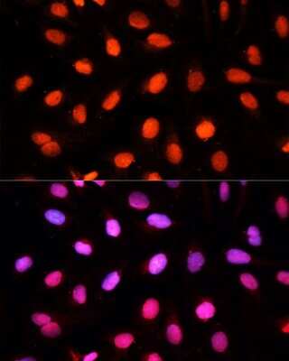 Immunocytochemistry/Immunofluorescence: NSUN2 Antibody [NBP2-94855] - Analysis of U2OS cells using NSUN2 at dilution of 1:100. Blue: DAPI for nuclear staining.