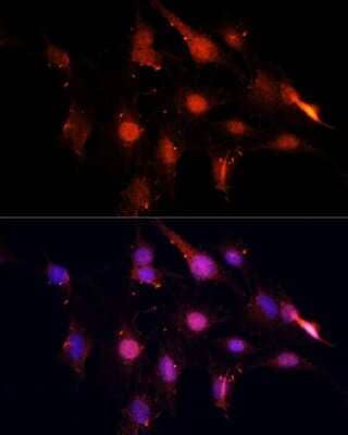 Immunocytochemistry/Immunofluorescence: NSUN2 Antibody [NBP2-94855] - Immunofluorescence analysis of C6 cells using NSUN2 antibody (NBP2-94855) at dilution of 1:100. Blue: DAPI for nuclear staining.