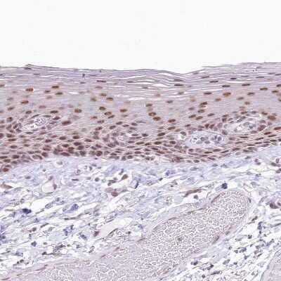 Immunohistochemistry-Paraffin: NSUN2 Antibody [NBP1-82189] - Staining of human skin shows weak to moderate nuclear positivity in squamous epithelial cells.