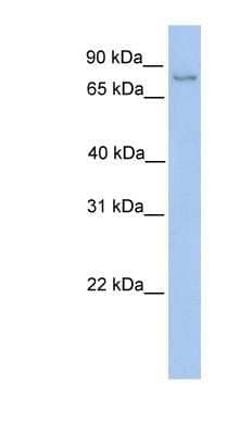 Western Blot: NSUN2 Antibody [NBP1-53052] - Hela cell lysate, concentration 0.2-1 ug/ml.