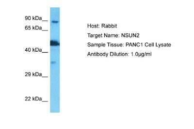 Western Blot: NSUN2 Antibody [NBP2-85404] - Host: Rabbit. Target Name: NSUN2. Sample Type: PANC1 Whole Cell lysates. Antibody Dilution: 1.0ug/ml