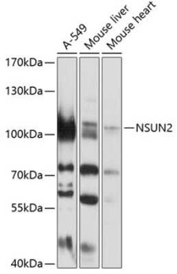 Western Blot: NSUN2 Antibody [NBP2-94855] - Analysis of extracts of various cell lines, using NSUN2 at 1:1000 dilution.Secondary antibody: HRP Goat Anti-Rabbit IgG (H+L) at 1:10000 dilution.Lysates/proteins: 25ug per lane.Blocking buffer: 3% nonfat dry milk in TBST.Detection: ECL Basic Kit .Exposure time: 10s.