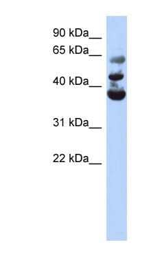 Western Blot: NSUN3 Antibody [NBP1-55169] - Titration: 0.2-1 ug/ml, Positive Control: Human Pancreas.