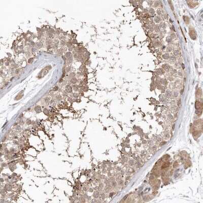 Immunohistochemistry-Paraffin: NSUN4 Antibody [NBP1-82733] - Staining of human testis shows strong cytoplasmic positivity in cells in seminiferous ducts.
