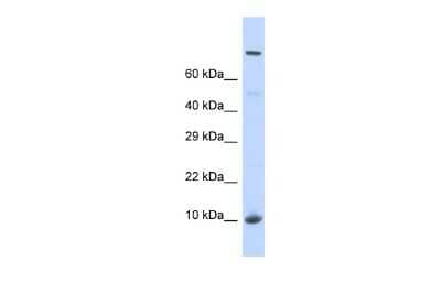 Western Blot: NSUN5B Antibody [NBP3-09309] - Western blot analysis of NSUN5B in Fetal Liver lysates. Antibody dilution at 1.0ug/ml