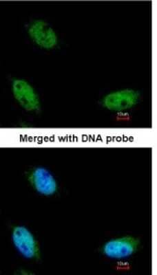 Immunocytochemistry/Immunofluorescence: NSUN6 Antibody [NBP1-32531] - Paraformaldehyde-fixed HeLa, using antibody at 1:200 dilution.