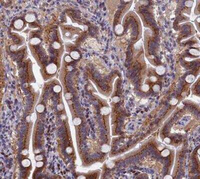 Immunohistochemistry-Paraffin: NSUN6 Antibody [NBP1-92202] - Staining of human duodenum shows strong granular cytoplasmic positivity in glandular cells.