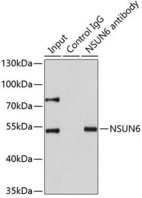 Immunoprecipitation: NSUN6 Antibody [NBP2-93013] - Analysis of 200ug extracts of HeLa cells using 1ug NSUN6 antibody. Western blot was performed from the immunoprecipitate using NSUN6 antibody at a dilition of 1:1000.