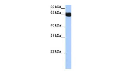Western Blot: NSUN6 Antibody [NBP2-85405] - WB Suggested Anti-NSUN6 Antibody Titration: 0.2-1 ug/ml. Positive Control: Human muscle