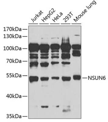 Western Blot: NSUN6 Antibody [NBP2-94132] - Analysis of extracts of various cell lines, using NSUN6 .Exposure time: 90s.