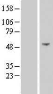 Western Blot: NSUN7 Overexpression Lysate (Adult Normal) [NBP2-06298] Left-Empty vector transfected control cell lysate (HEK293 cell lysate); Right -Over-expression Lysate for NSUN7.