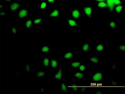 Immunocytochemistry/Immunofluorescence: NT5C Antibody [H00030833-B01P] - Analysis of purified antibody to NT5C on HeLa cell. (antibody concentration 10 ug/ml)