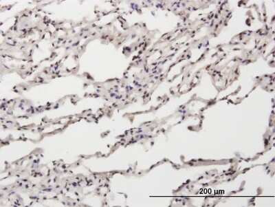 Immunohistochemistry-Paraffin: NT5C Antibody [H00030833-B01P] - Analysis of purified antibody to NT5C on formalin-fixed paraffin-embedded human lung. (antibody concentration 3 ug/ml)