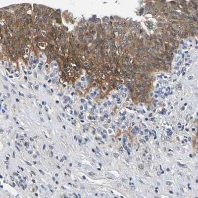 Immunohistochemistry-Paraffin: NT5C Antibody [NBP1-84564] - Staining of human urinary bladder shows moderate cytoplasmic positivity in urothelial cells.