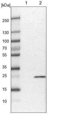 Western Blot: NT5C Antibody [NBP1-84564] - Lane 1:  NIH-3T3 cell lysate (Mouse embryonic fibroblast cells)  Lane 2: NBT-II cell lysate (Rat Wistar bladder tumor cells).